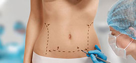 Abdominoplasty (Tummy Tuck)
